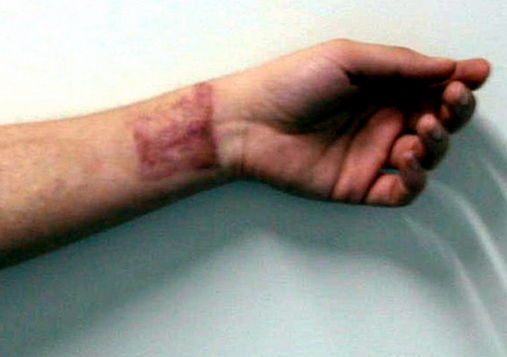 scars-fig1