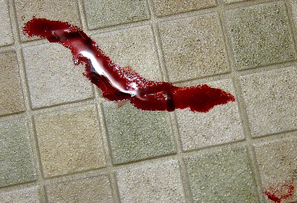 blood-on-the-bathroom-floor_0636